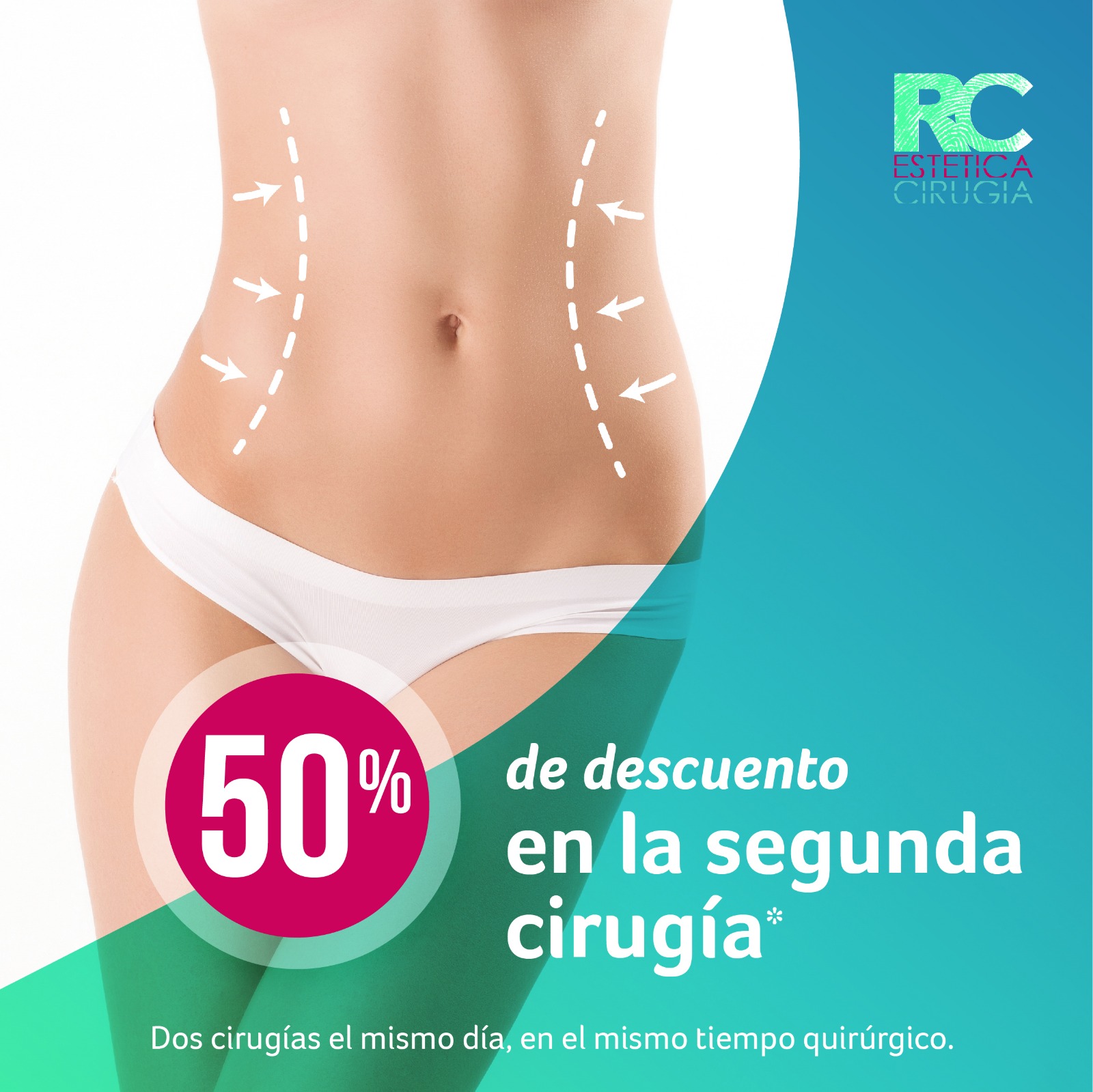 Segunda Cirugía al 50% - CIRUGÍA ESTÉTICA MADRID